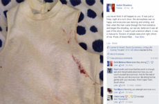 Paris attack survivor played dead for over an hour as gunmen opened fire