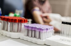 Doctors defend charging medical card patients for blood tests