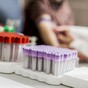Doctors defend charging medical card patients for blood tests