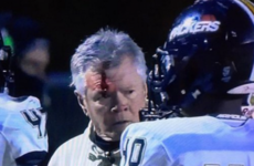Definitive proof -- if it were needed -- that headbutting someone wearing a helmet is a bad idea