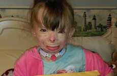 This little girl who lost her whole family in a fire only wants cards for Christmas