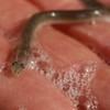 Spa treatment leaves man with eel in his... urethra