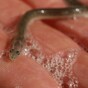 Spa treatment leaves man with eel in his... urethra