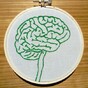 Galway team pinpoints part of brain which produces "marijuana-like substances" to dull pain