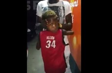 This little boy's insanely flexible neck is freaking the internet out