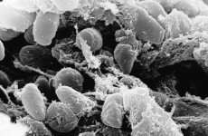 Scientists crack genetic code of Black Death plague