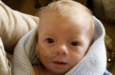 Surgery scheduled for baby Noah after father speaks out