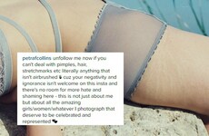This photographer called out people on Instagram who can't deal with her shots of hairy armpits