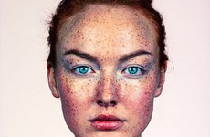 This photographer has dedicated himself to capturing the beauty of freckles