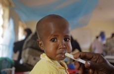 Substandard food aid "fails malnourished children"