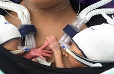 People are sharing these lovely photos of premature twins who won't stop holding hands