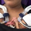 People are sharing these lovely photos of premature twins who won't stop holding hands