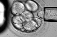 European Court bans patenting of embryonic stem cells for research