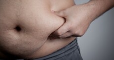 Overweight people should pay more tax. Others can't pay for our folly