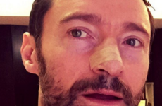 Hugh Jackman tells people to wear sunscreen after another skin cancer surgery