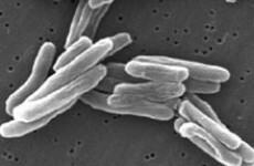 Cloverhill inmates, staff being screened for tuberculosis
