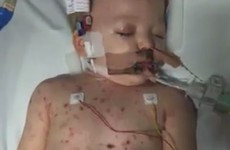 Matt Dawson shares images of two-year-old son battling meningitis to raise awareness