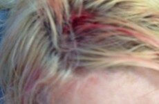 Woman taken to hospital after being struck on head by election poster