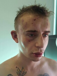 "I thought I was going to die" - Irish man beaten up twice in one night 'for being gay'