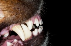 Schoolgirl awarded €40k after 'savage' attack by neighbour's dog