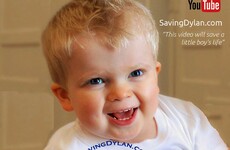 Only 18 people in the world have this rare disease - an Irish 3-year-old is one