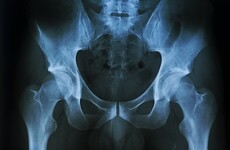 Irish doctors find unusual 'violent trauma' injury in young rugby players