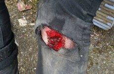 Six arrested as protesters left bloodied at anti-circus demo in Tallaght