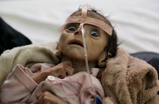 Born in the middle of a war, this baby starved to death after just five months of life