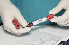 New rapid HIV testing project looking to Ireland's bars and workplaces