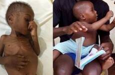 PHOTOS: This starving boy has made a wonderful recovery two months after being rescued