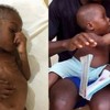PHOTOS: This starving boy has made a wonderful recovery two months after being rescued