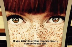 Dating website apologises for calling red hair and freckles 'imperfections'