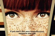 Dating website apologises for calling red hair and freckles 'imperfections'