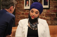 This bearded model on The Late Late Show inspired everyone with her courage and confidence
