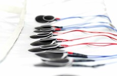 Hundreds of Irish people are still undergoing electro-shock therapy