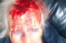 Appeal after woman in her 90s struck on head with a stick in handbag robbery
