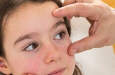Eye exams for schoolchildren have been cut by the HSE
