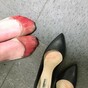 This viral photo of a waitress' feet after her shift illustrates why heels are EVIL