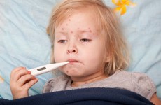 Measles warning after second case confirmed this year