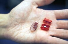 You can swallow this origami robot and it will help patch you up