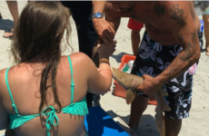 Woman goes to hospital with shark attached to her arm after being bitten at Florida beach