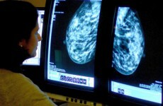Mammograms not as effective at detecting cancer as previously thought, says study