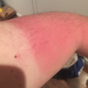 Here's why a farmer's tan is the hottest look this summer