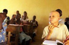 Malawi court bans witchdoctors following spate of albino killings