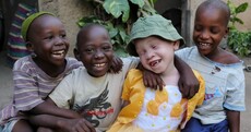 Ukerewe: A haven for albinos in a country where they're murdered for their body parts