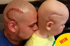 This dad got a tattoo of his son's cancer surgery scar to help him feel better about it