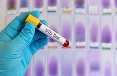 Students at NUI Galway are getting an STI clinic
