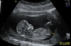 A Spanish fertility clinic that plays music to foetuses has bought a surgery in Kildare