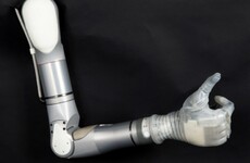 A decade on, Segway creator's prosthetic arm will arrive at the end of the year