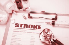 Strokes are largely preventable with 10 risk factors responsible for 90% of them